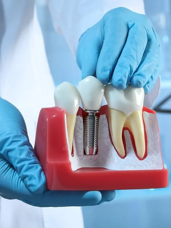 Close-up of a dental implant